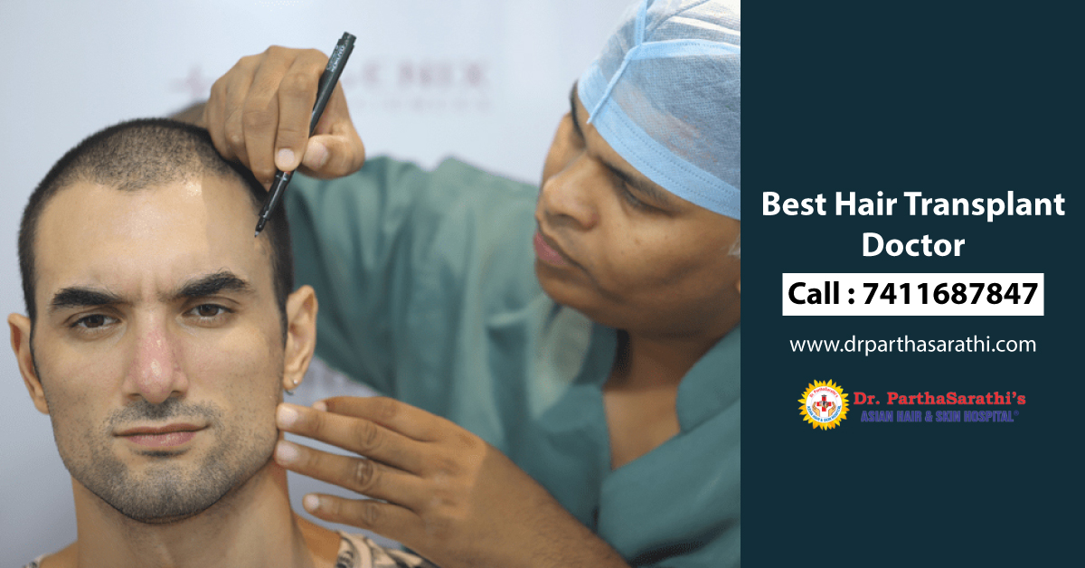best hair transplant doctor  in Koramangala, Indira Nagar, MG Road, Bangalore